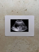 The Name Nest Baby on the Way Ultrasound Card